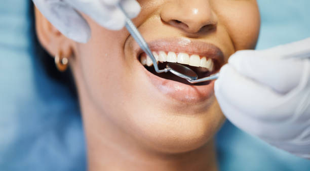 Best Emergency Treatment for Dental Infections or Abscesses in Westerville, OH